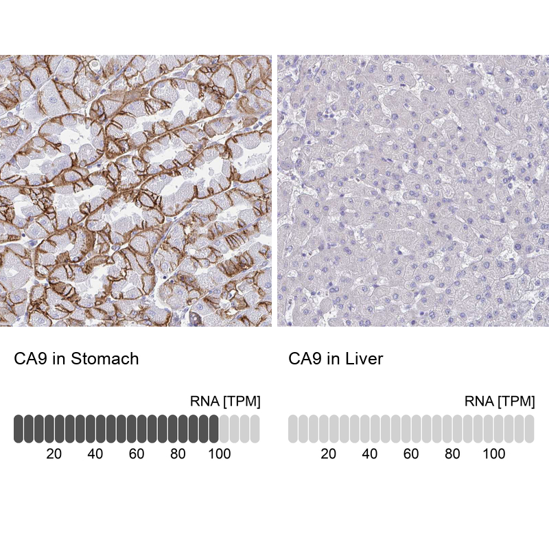 Atlas Antibodies Anti-CA9 Antibody