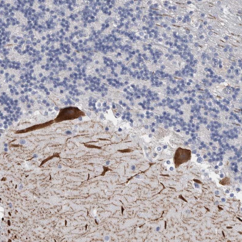 Atlas Antibodies Anti-CA8 Antibody