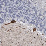 Atlas Antibodies Anti-CA8 Antibody