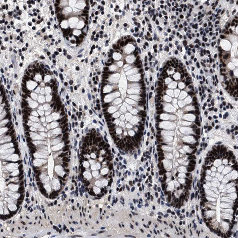 Atlas Antibodies Anti-CAAP1 Antibody