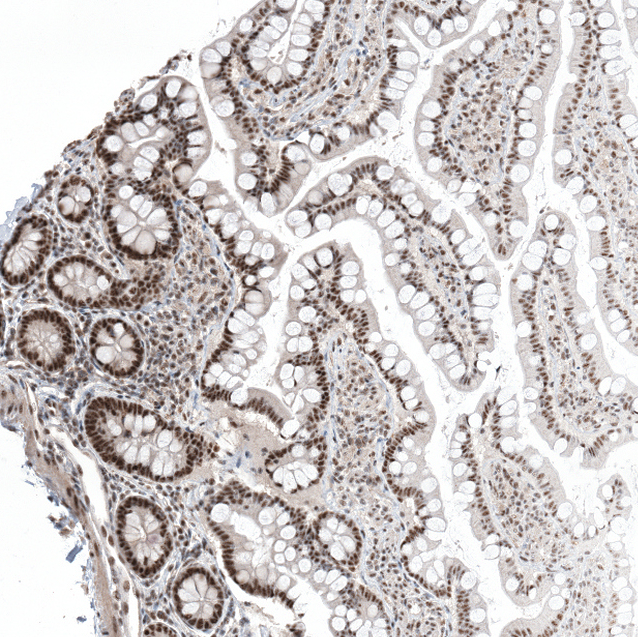 Atlas Antibodies Anti-CAAP1 Antibody