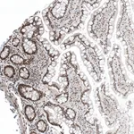 Atlas Antibodies Anti-CAAP1 Antibody