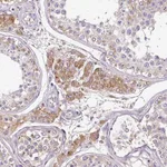 Atlas Antibodies Anti-CAB39L Antibody