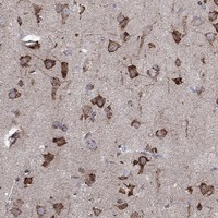 Atlas Antibodies Anti-CAB39L Antibody