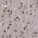 Atlas Antibodies Anti-CAB39L Antibody