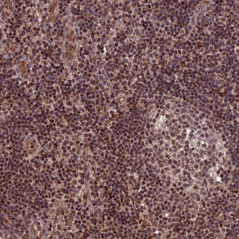 Atlas Antibodies Anti-CABIN1 Antibody