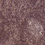 Atlas Antibodies Anti-CABIN1 Antibody