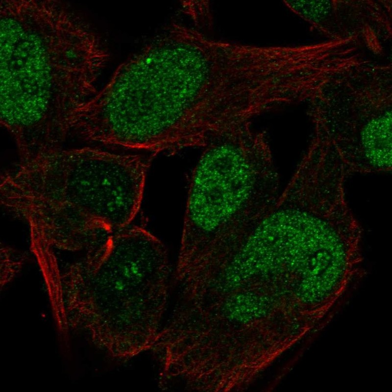 Atlas Antibodies Anti-CABLES1 Antibody