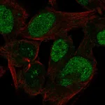 Atlas Antibodies Anti-CABLES1 Antibody