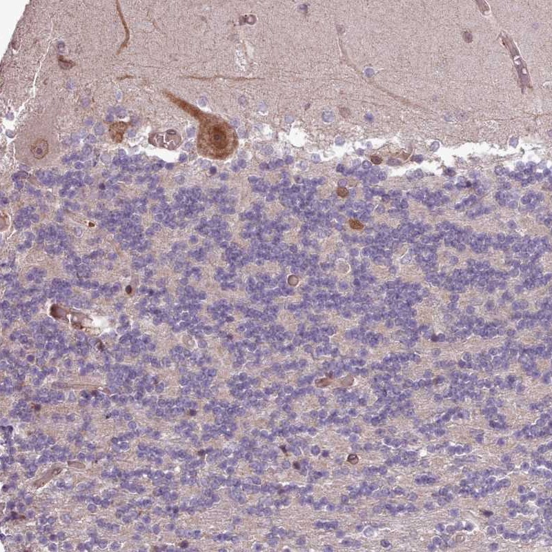 Atlas Antibodies Anti-CABP1 Antibody