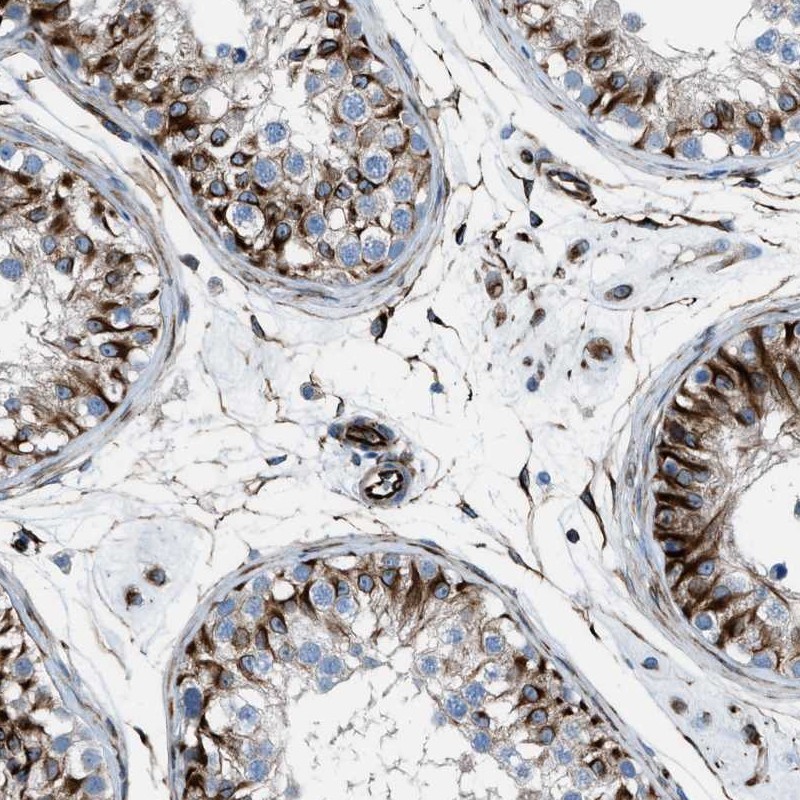Atlas Antibodies Anti-CABP7 Antibody