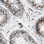 Atlas Antibodies Anti-CABP7 Antibody