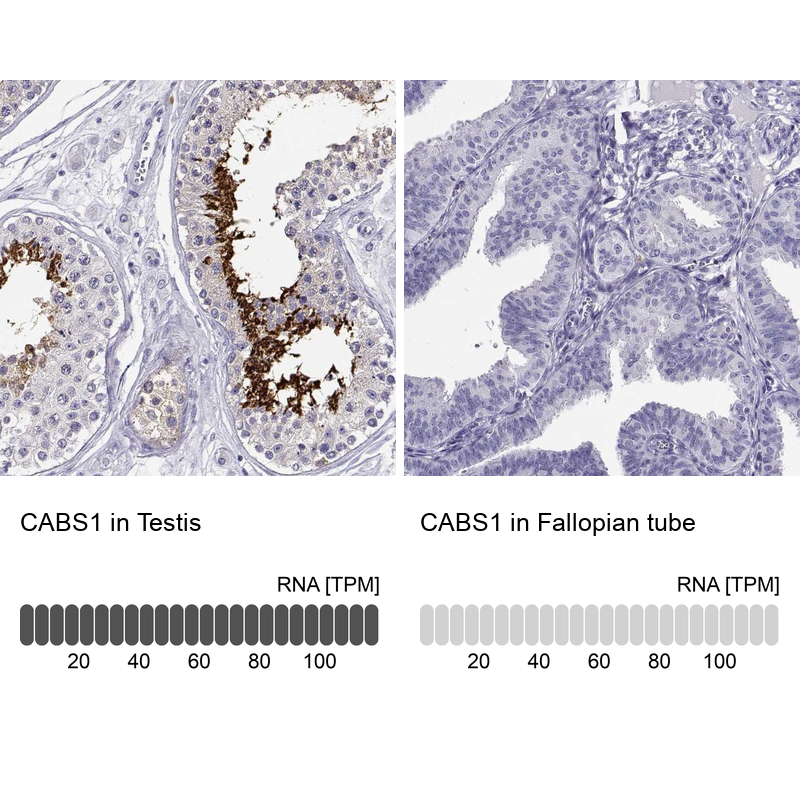 Atlas Antibodies Anti-CABS1 Antibody
