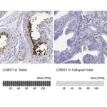 Atlas Antibodies Anti-CABS1 Antibody
