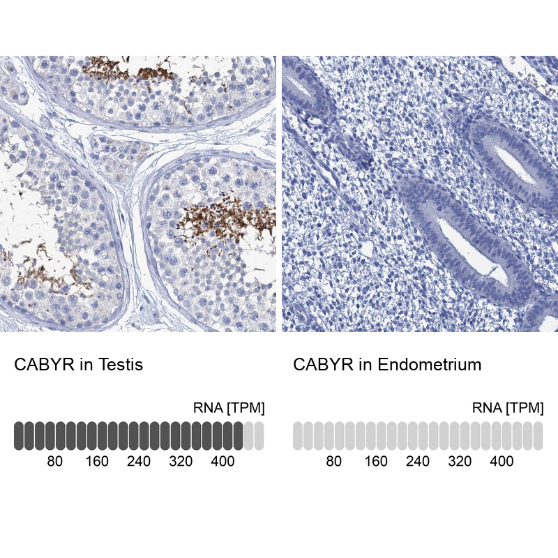 Atlas Antibodies Anti-CABYR Antibody
