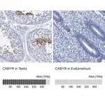 Atlas Antibodies Anti-CABYR Antibody