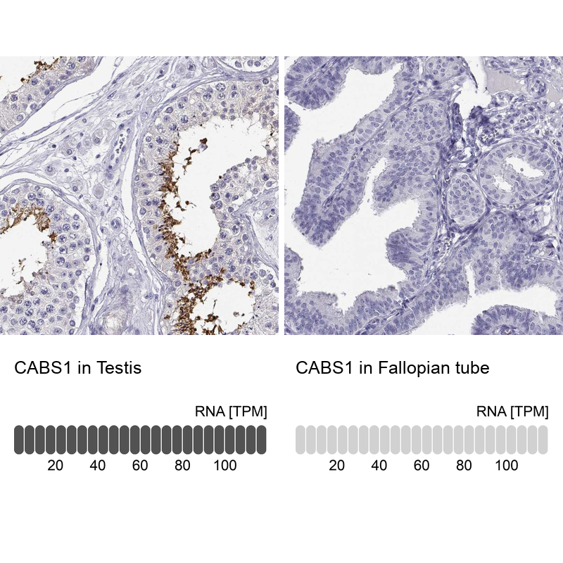 Atlas Antibodies Anti-CABS1 Antibody
