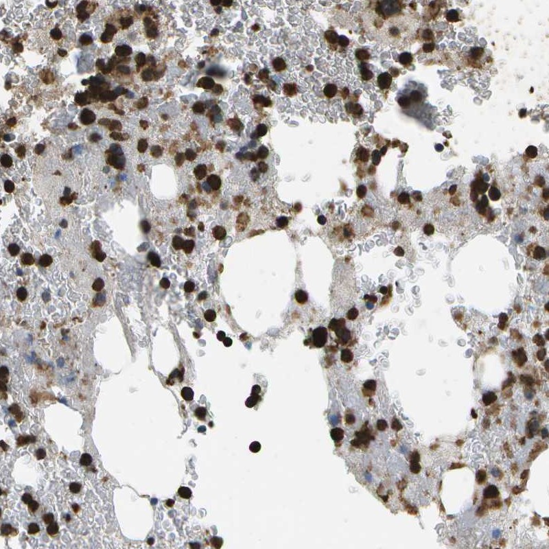 Atlas Antibodies Anti-CACHD1 Antibody