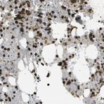 Atlas Antibodies Anti-CACHD1 Antibody