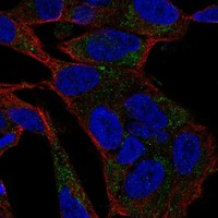 Atlas Antibodies Anti-CACNA1B Antibody
