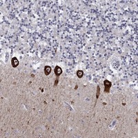 Atlas Antibodies Anti-CACNA1A Antibody