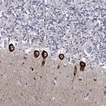 Atlas Antibodies Anti-CACNA1A Antibody