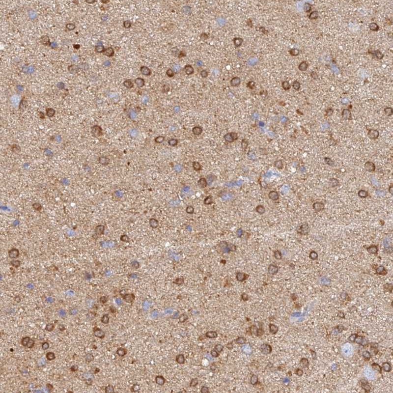 Atlas Antibodies Anti-CACNA1B Antibody