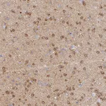 Atlas Antibodies Anti-CACNA1B Antibody