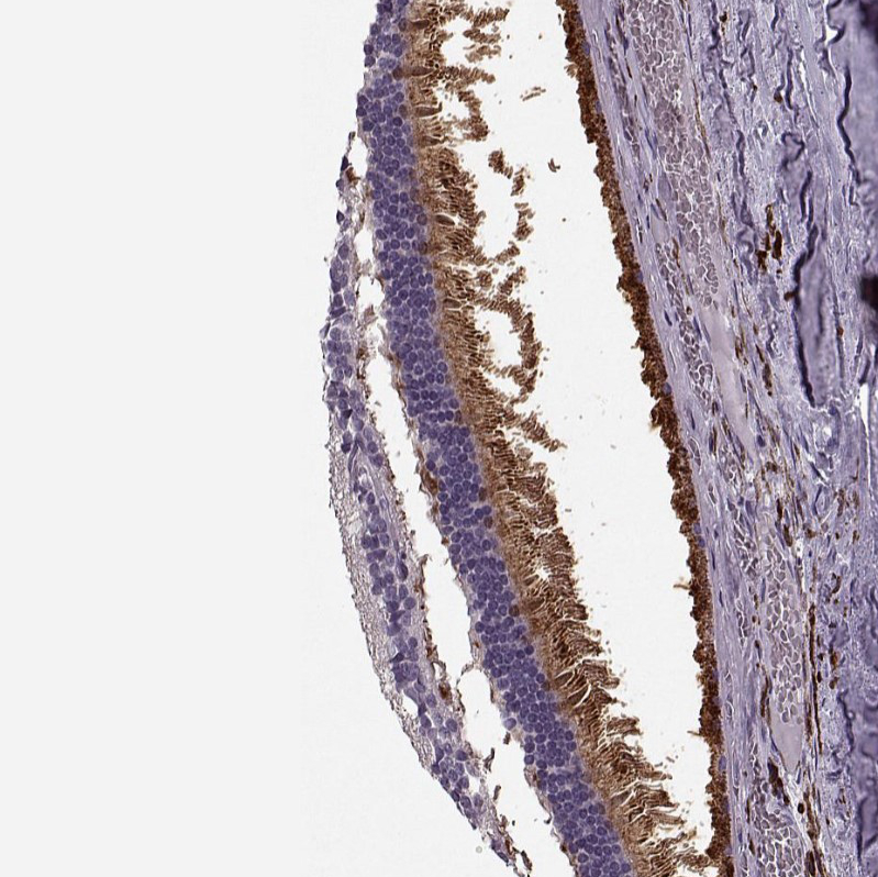Atlas Antibodies Anti-CACNA1F Antibody