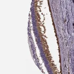 Atlas Antibodies Anti-CACNA1F Antibody