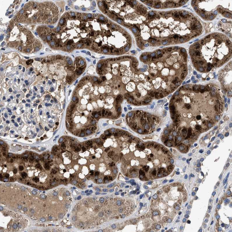 Atlas Antibodies Anti-CACNA1D Antibody