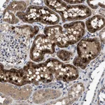 Atlas Antibodies Anti-CACNA1D Antibody