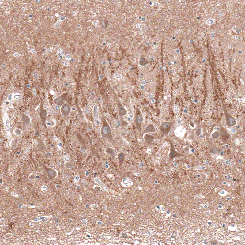 Atlas Antibodies Anti-CACNA1H Antibody