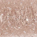 Atlas Antibodies Anti-CACNA1H Antibody