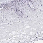 Atlas Antibodies Anti-CACNA1S Antibody