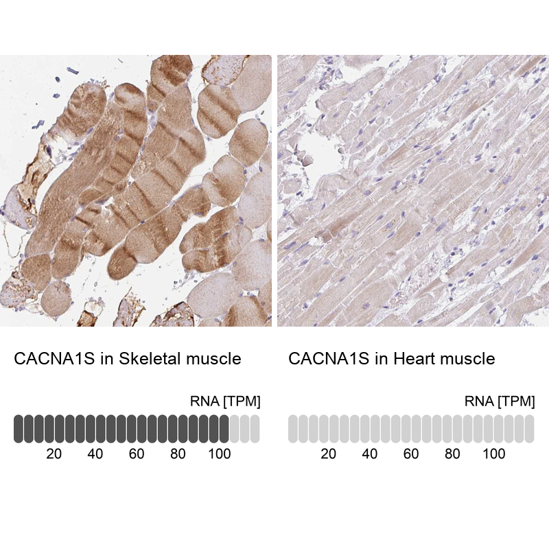 Atlas Antibodies Anti-CACNA1S Antibody