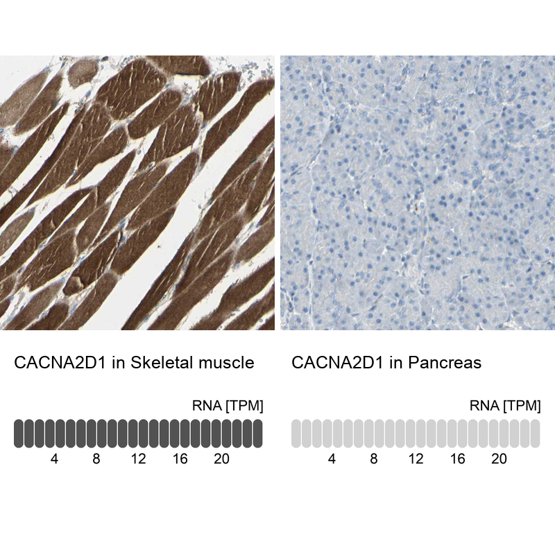 Atlas Antibodies Anti-CACNA2D1 Antibody