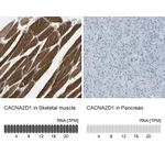 Atlas Antibodies Anti-CACNA2D1 Antibody