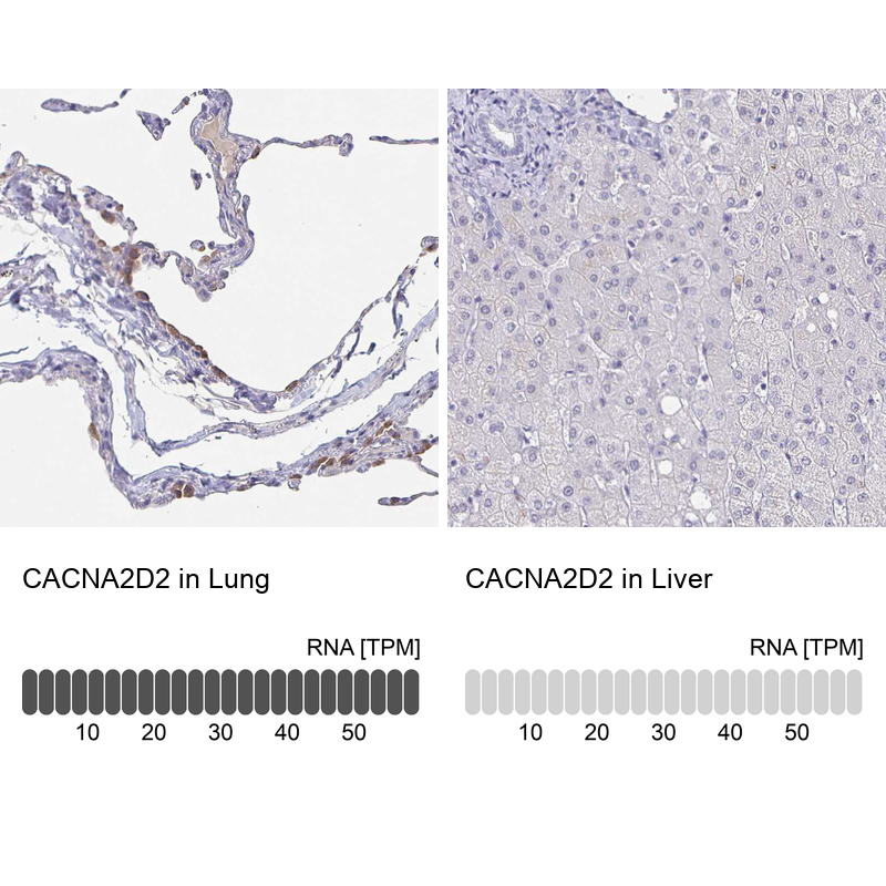 Atlas Antibodies Anti-CACNA2D2 Antibody