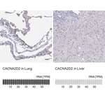 Atlas Antibodies Anti-CACNA2D2 Antibody