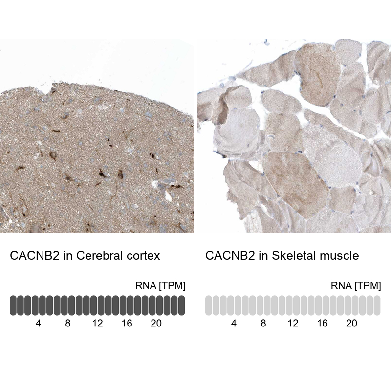 Atlas Antibodies Anti-CACNB2 Antibody