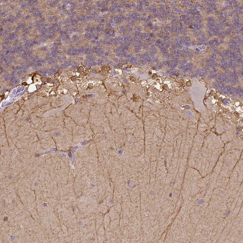Atlas Antibodies Anti-CACNB1 Antibody
