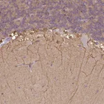 Atlas Antibodies Anti-CACNB1 Antibody