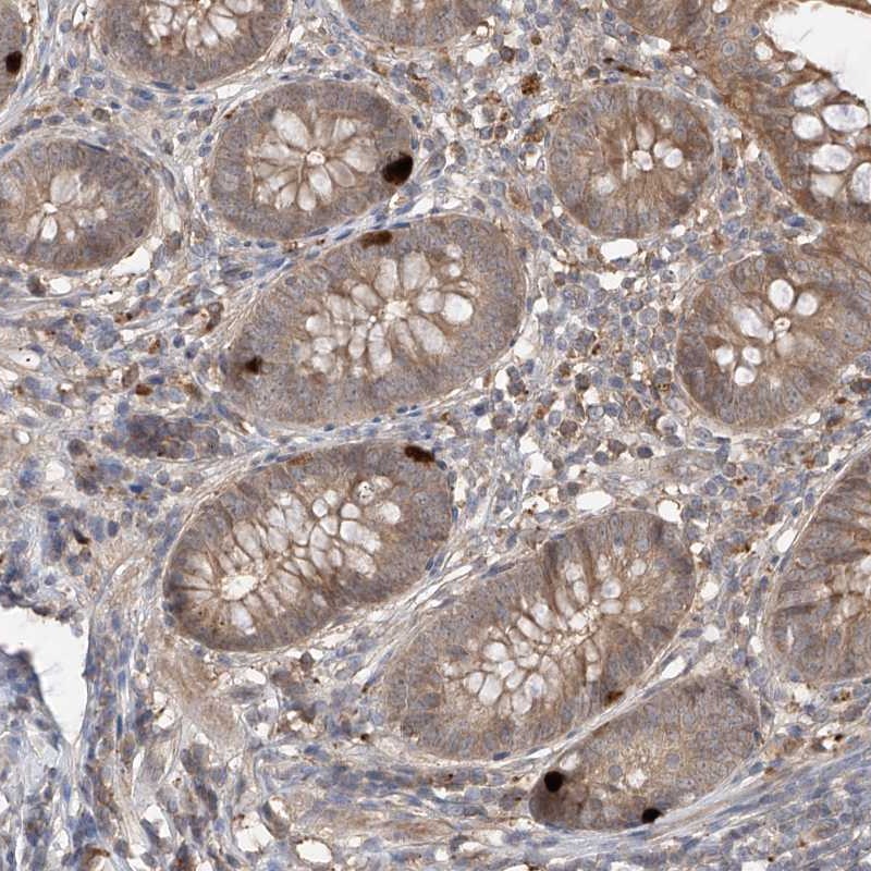 Atlas Antibodies Anti-CACNA2D4 Antibody