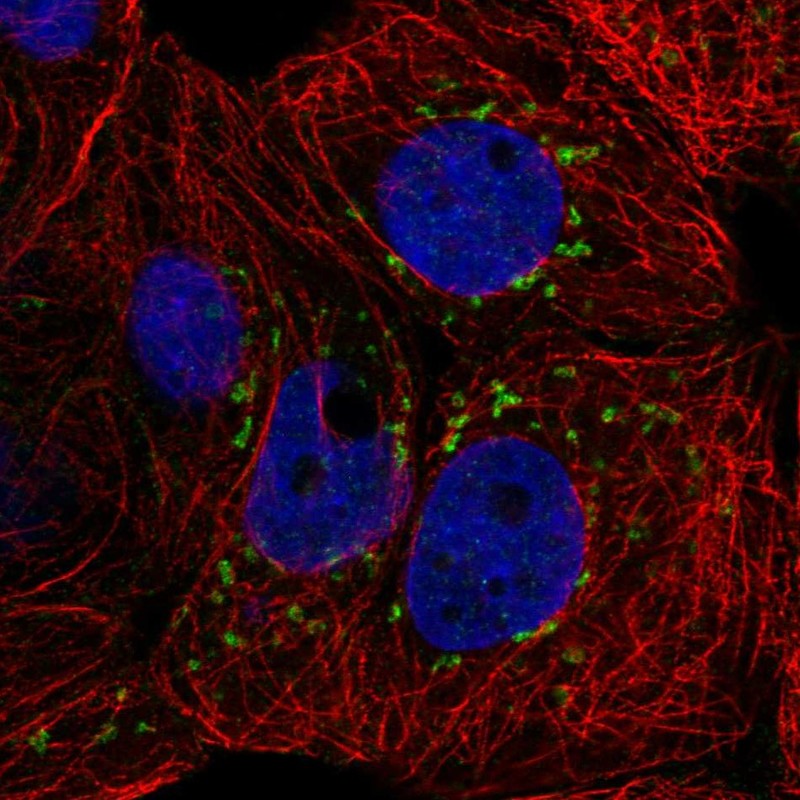 Atlas Antibodies Anti-CACNB3 Antibody