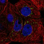Atlas Antibodies Anti-CACNB3 Antibody