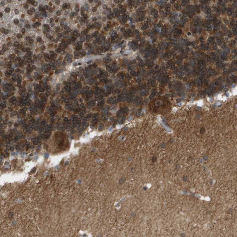 Atlas Antibodies Anti-CACNB4 Antibody