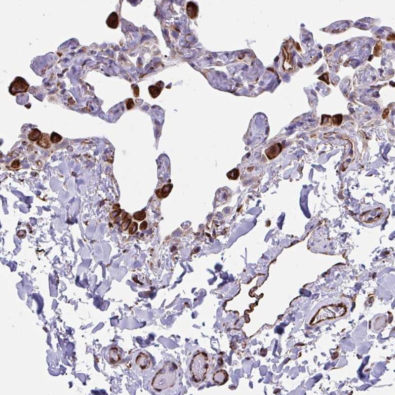 Atlas Antibodies Anti-CACNG3 Antibody