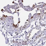 Atlas Antibodies Anti-CACNG3 Antibody