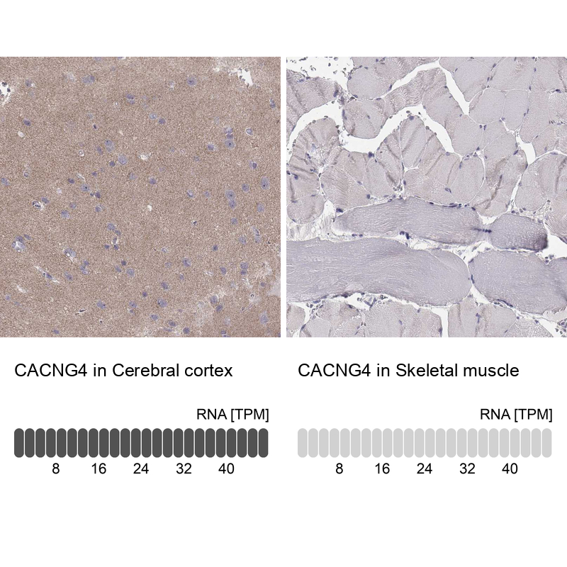 Atlas Antibodies Anti-CACNG4 Antibody